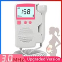 Fetal Doppler [Non Merk]