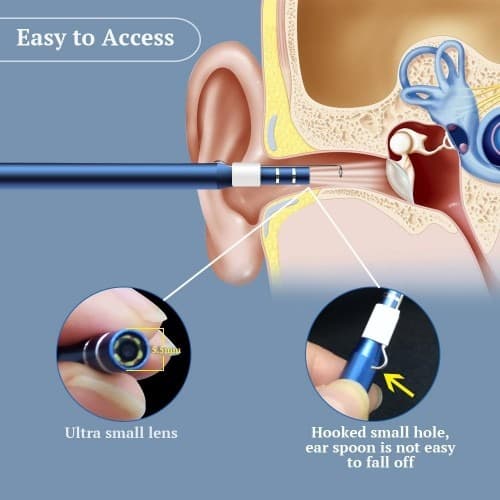 Otoskop/Ear Cleaning i98