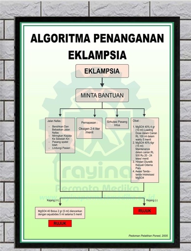 Poster Kesehatan Algoritma Penanganan Eklampsia